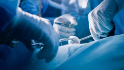 opioid-free surgery addiction